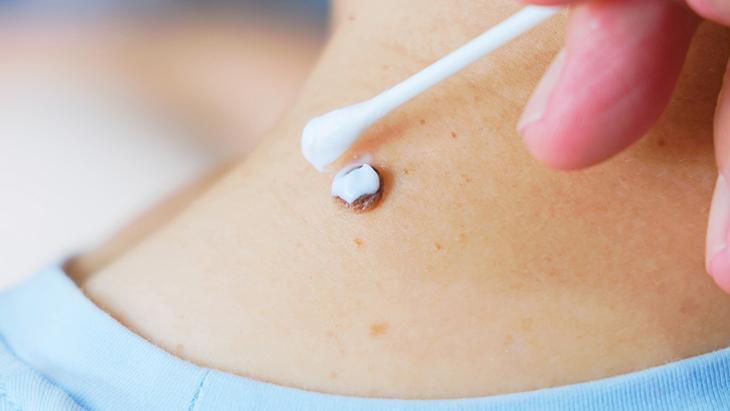 lazer de yaptiran da var solusyon suren de her ben masum degil incelenmeli WGkOSDPR.jpg