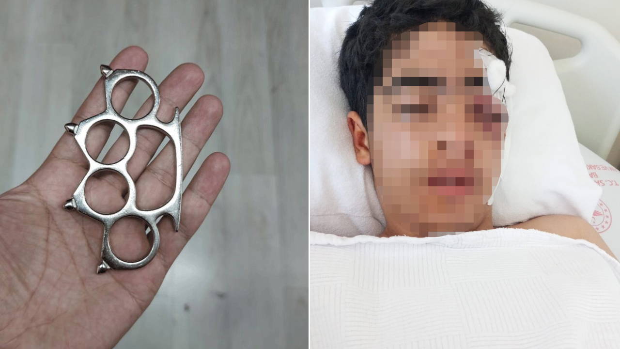 Esenyurt’ta 15 Yaşındaki Çocuğa Akranından Muşta ile Saldırı: Sağlığı Tehlikede!